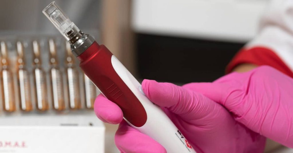 Gloved hand holding a microneedling pen.